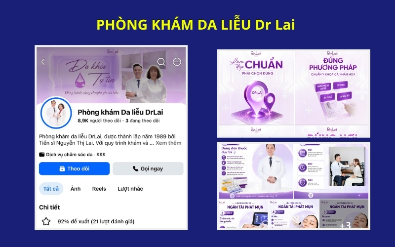 Dịch vụ quản trị fanpage trọn gói